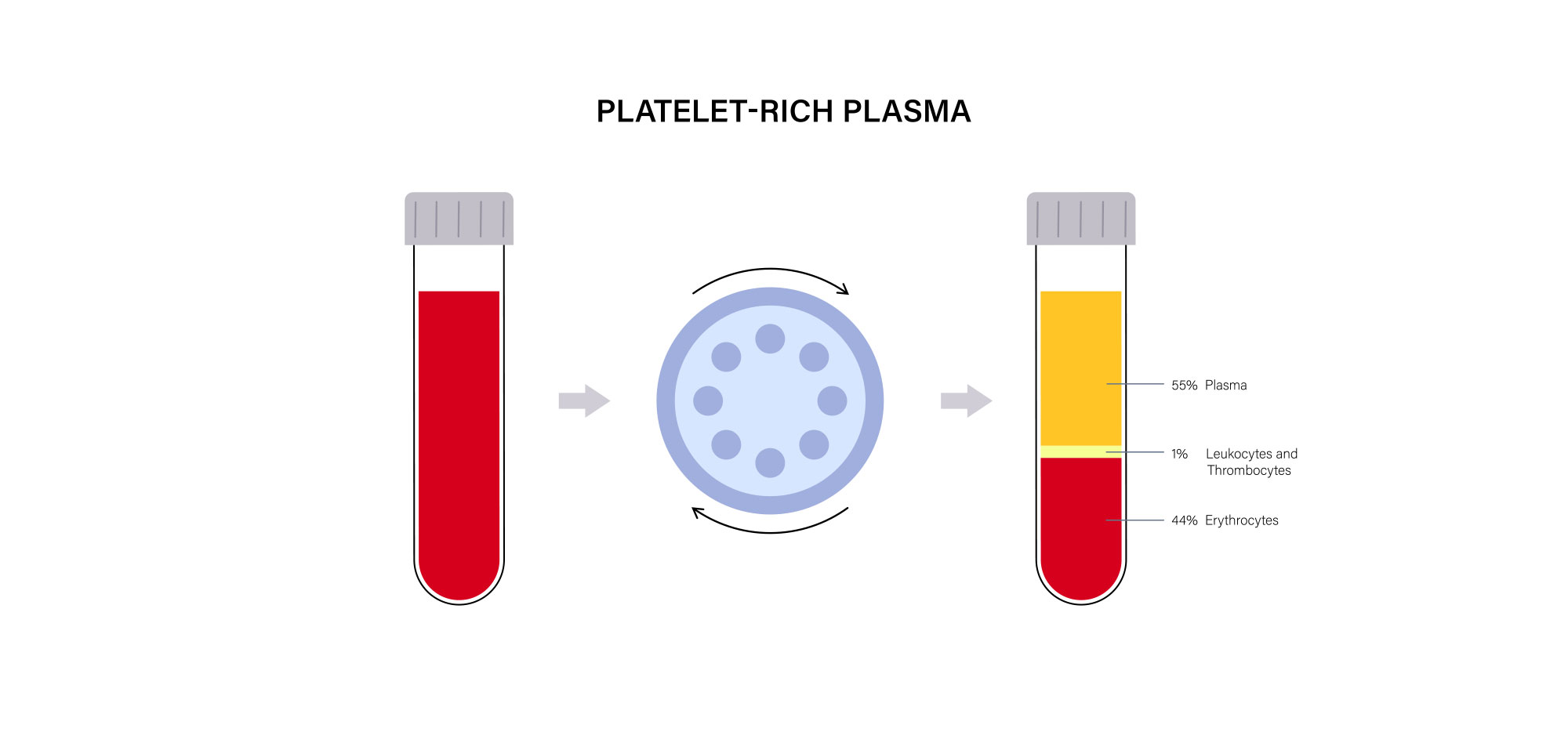Platelet-Rich PLASMA
